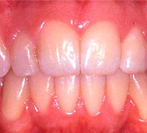 Clínica Dental Rodolfo Pita dientes saludables